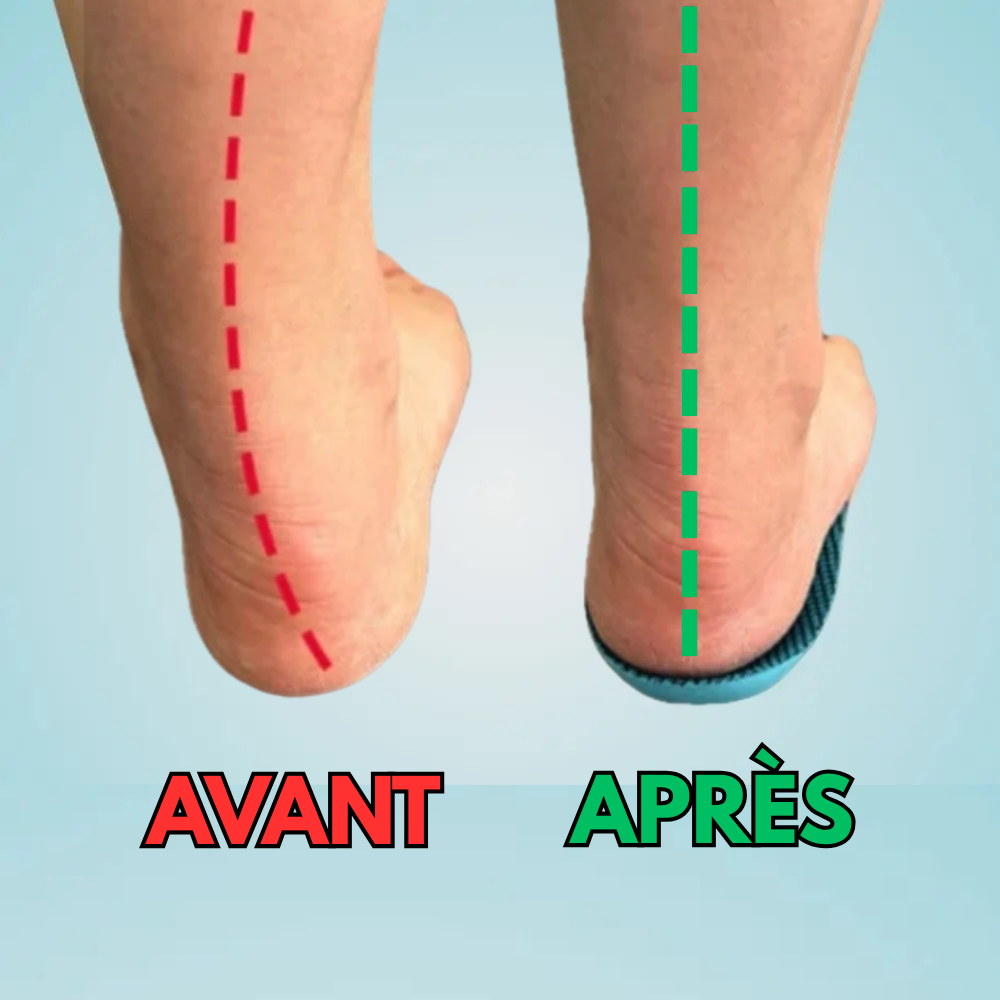 ConfortFlex – Soulagez vos pieds dès aujourd’hui, sans rendez-vous ni médicament