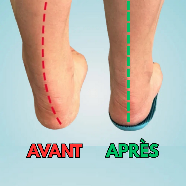 ConfortFlex – Soulagez vos pieds dès aujourd’hui, sans rendez-vous ni médicament